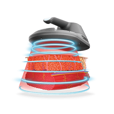 Emsculpt_PIC_Web-product-page-applicator_400x400_EN100_1641452678_original